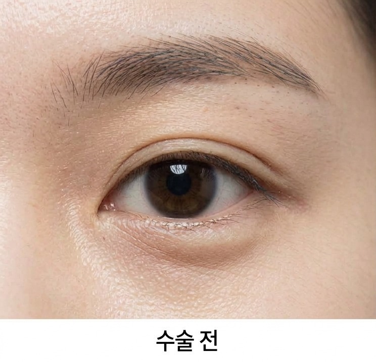 시술 전 클로즈업